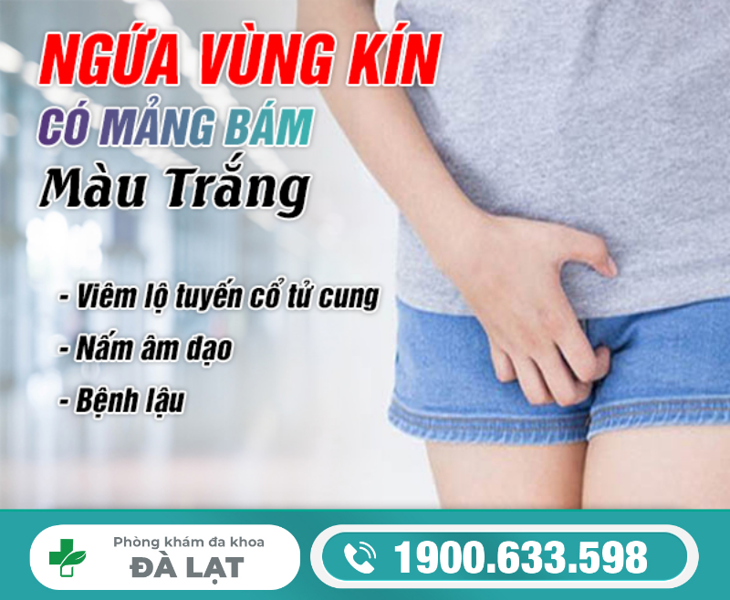 Hình ảnh minh họa